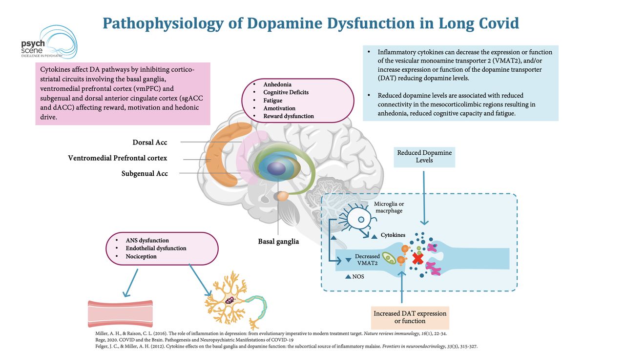 Long COVID linked to lower dopamine levels in brain, study finds