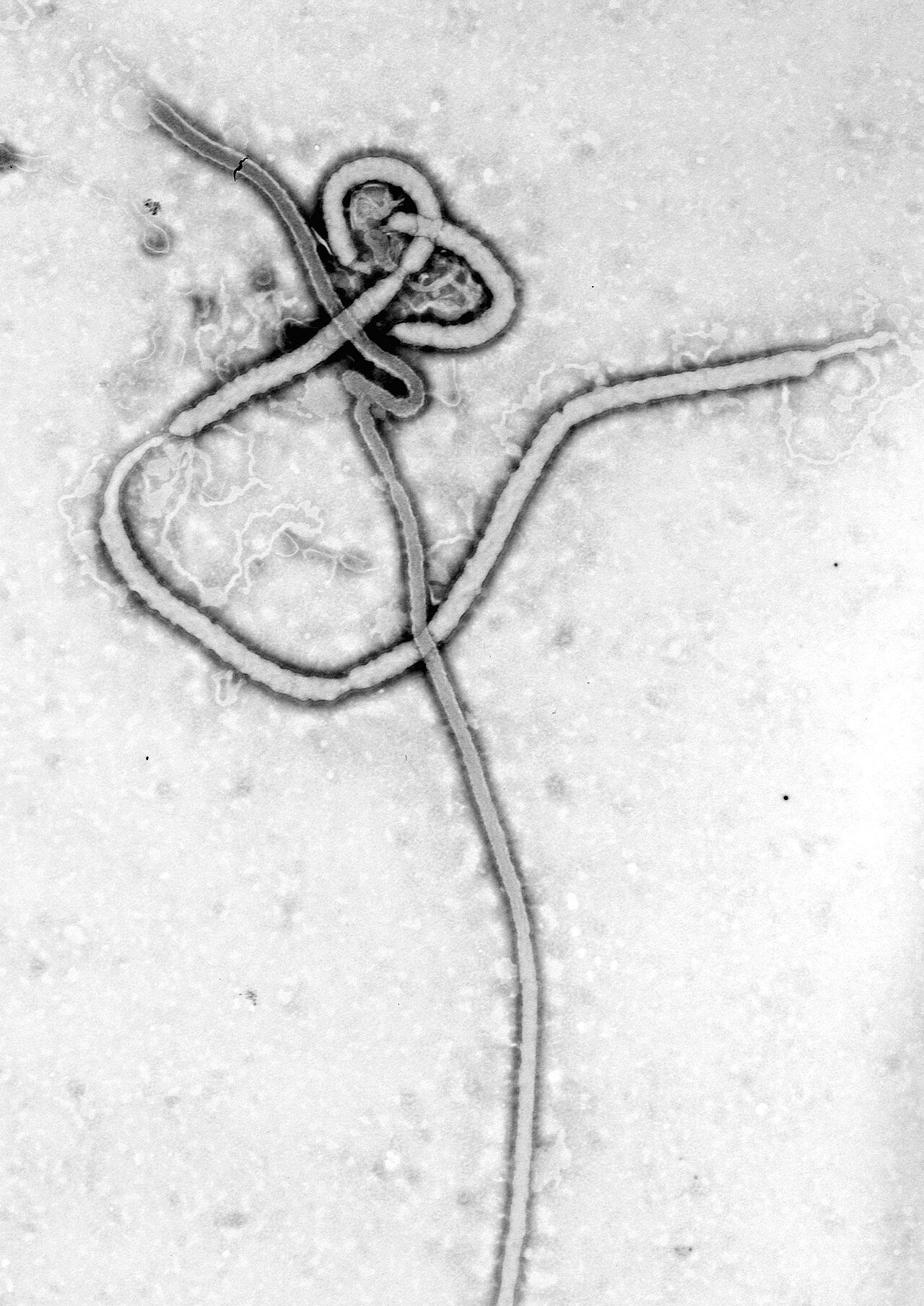 U.S. to require Ebola travel declaration for all international air passengers